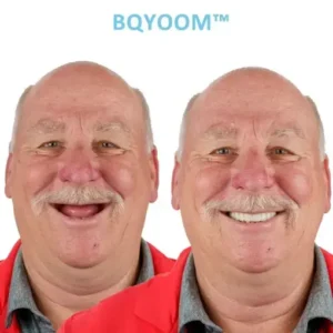 BQYOOM™ GelFit Dentures