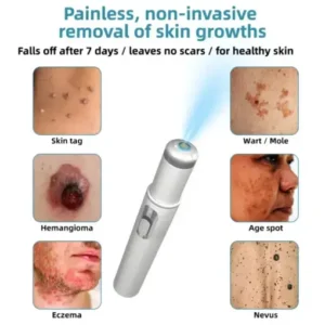 BQYOOM™ Non-Invasive Mole and Wart Removal Laser Pen