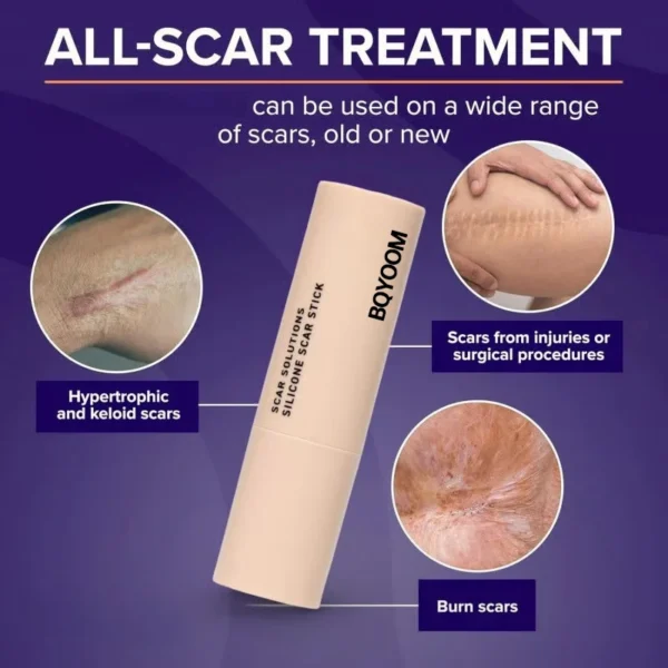 BQYOOM Silicone Scar Stick - For Face and Body - Image 3