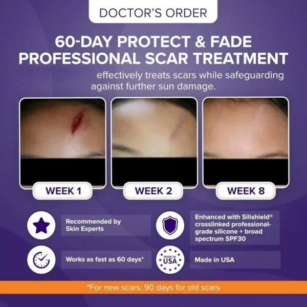 BQYOOM Silicone Scar Stick - For Face and Body - Image 6