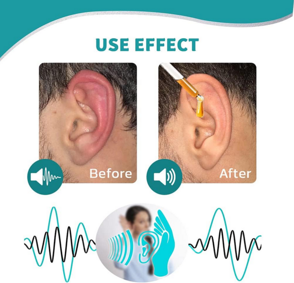 BQYOOM™ Ear Care Drops - Image 3
