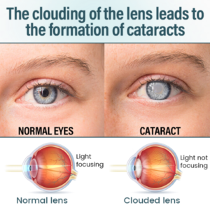 BQYOOM™ VisionFuse Nano Eye Drops Serum