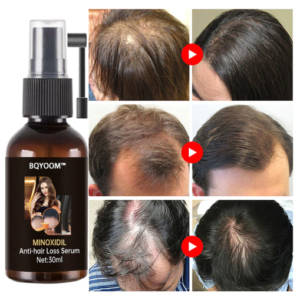 BQYOOM™ Rapid Hair Regrowth Oil