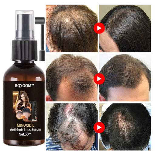 BQYOOM™ Rapid Hair Regrowth Oil