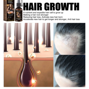 BQYOOM™ Rapid Hair Regrowth Oil