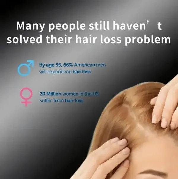 BQYOOM™ Professional Anti-Hair Loss Roll-On – Stimulates Hair Growth in 1–2 Weeks