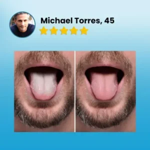 BQYOOM™ Tongue Coating Cleaning Gel