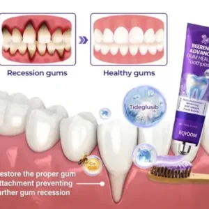 BQYOOM™ Tongue Coating Cleaning Gel