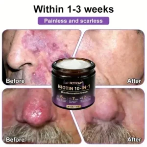 BQYOOM™ Biotin 10-in-1 Skin Restoration Cream