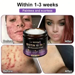 BQYOOM™ Biotin 10-in-1 Skin Restoration Cream