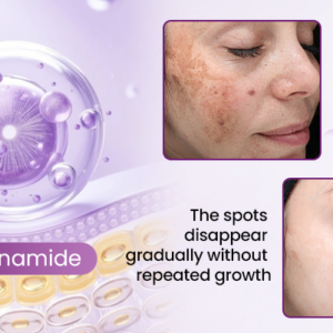 Alternative view of BQYOOM™ RadiantClear Blemish & Brightening Serum