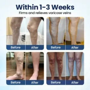 BQYOOM® Deep Vein Repair Microneedle Patch