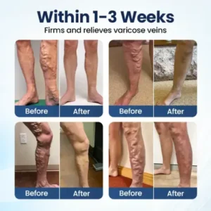BQYOOM® Deep Vein Repair Microneedle Patch