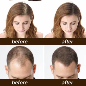 Alternative view of BQYOOM™ Rapid Hair Regrowth Oil